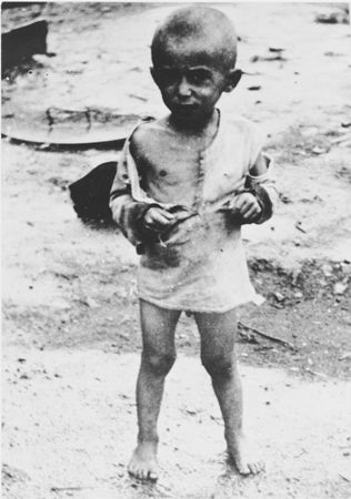emaciated child at the Jasenovac camp